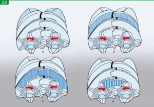 無油螺桿空壓機(jī)和噴油螺